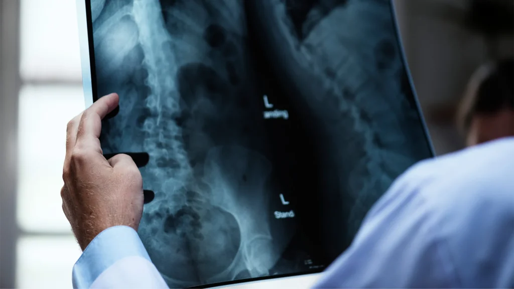 Doctor Holding Patient X-Ray