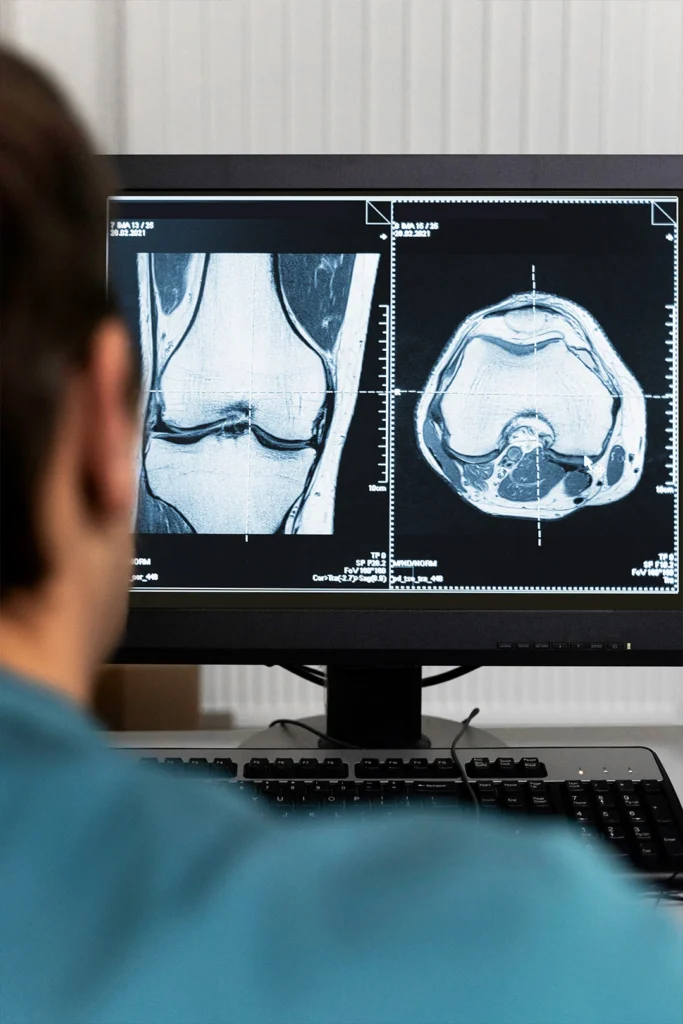 Woman Looks At X-Ray Images On Computer Screen
